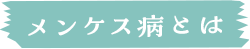 メンケス病